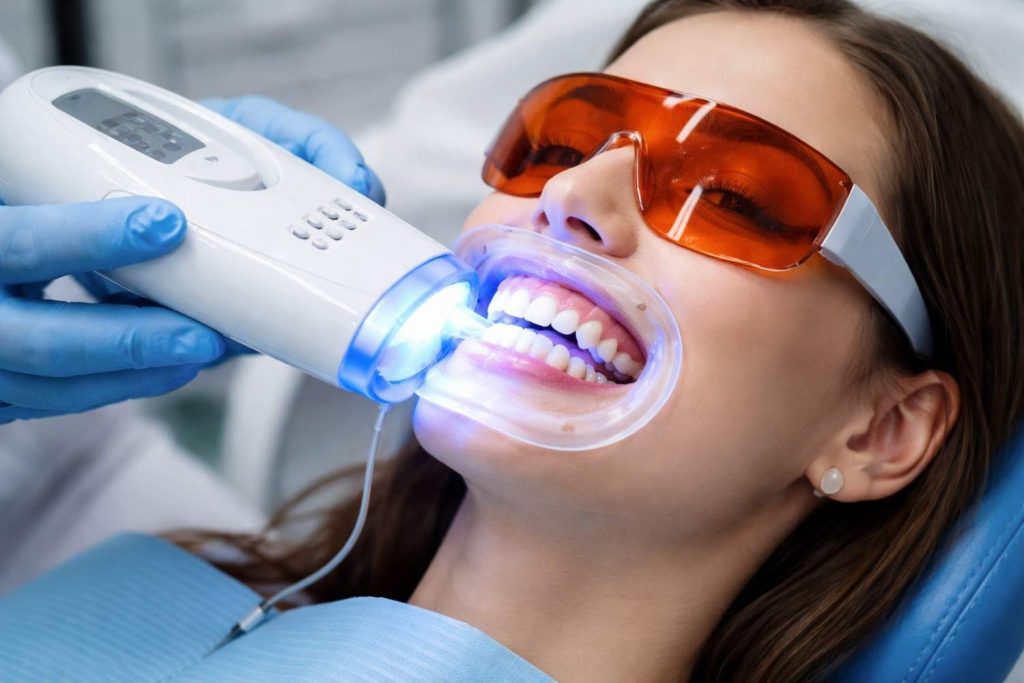 Teeth Sensitivity After Whitening