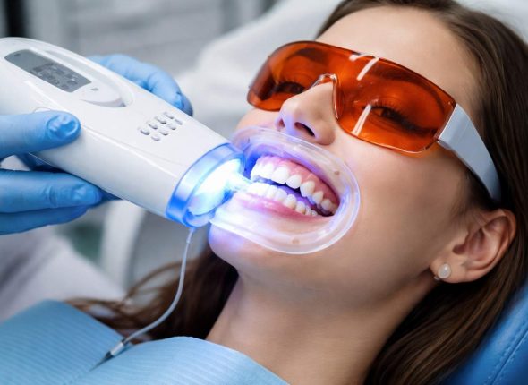 Teeth Sensitivity After Whitening